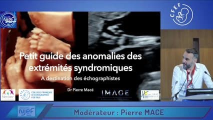 Petit guide des anomalies des extrémités syndromiques à destination des échographistes