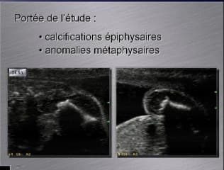 Etude sur les épiphyses