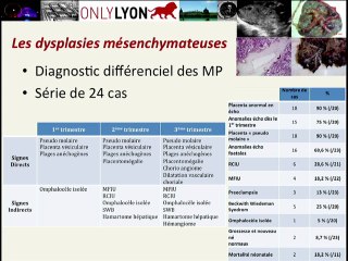 Les Centres de référence Maladies Rares : Centre Franc_ais des Maladies Trophoblastiques