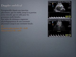 POSTER Doppler Utérin-Ombilical