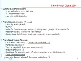 Signes échographiques de l'infection à CMV