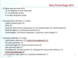 Signes échographiques de l'infection à CMV