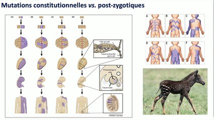 Hypertrophie fœtale segmentaire : comment orienter le diagnostic
