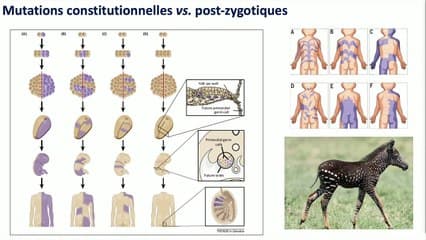 Hypertrophie fœtale segmentaire : comment orienter le diagnostic