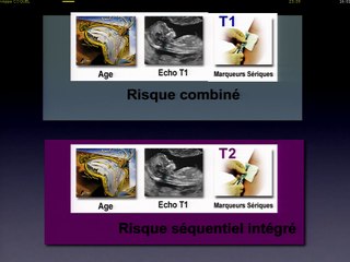 Contrôle de qualité de la mesure de LCC