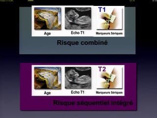 Contrôle de qualité de la mesure de LCC