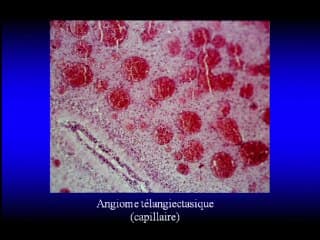 La fosse postérieure