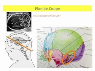 Croissance du cervelet