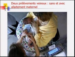 La douleur du nouveau-né : magnitude du problème et prise en charge