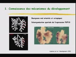Articles récents et immanquables en pneumologie périnatale. Ce qu'il faut retenir
