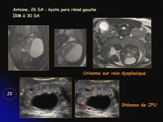 Les néphropathies et les uropathies : à propos de quelques cas difficiles.