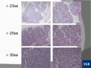 N’oubliez pas le pancréas.