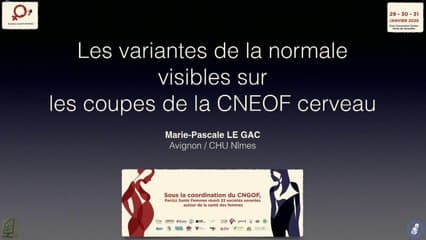 Les variantes de la normale visibles sur les coupes de la CNEOF Cerveau