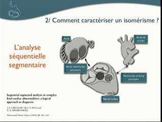 Malformations cardiaques : Isomérismes : Pas si compliqué ?