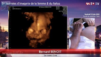 Le crâne › Live on demand