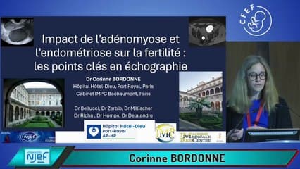 Impact de l’adénomyose et l’endométriose sur la fertilité : les points clés en échographie