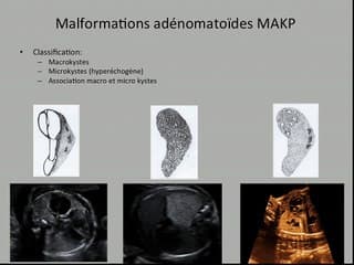 Images intra-thoraciques : cas cliniques.
