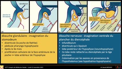 Imagerie de l’hypophyse foetale
