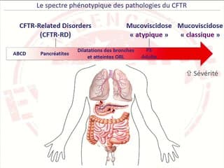 L'enquête génétique dans la mucoviscidose : crimes et délits des mutations du CFTR.