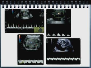 quand le coeur s'épanche