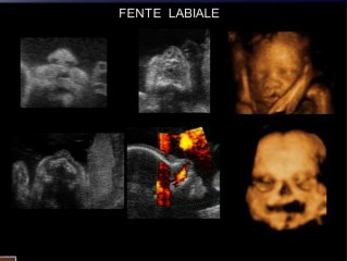Les malformations de la face