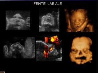 Les malformations de la face