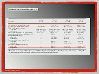 MISE AU POINT SUR LES GROSSESSES GÉMELLAIRE Pourquoi une échographie tous les 15 jours dans lesgrossesses monochoriales