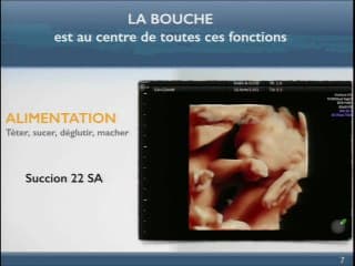 La qualité de l’oralité, avenir de l’échographie faciale. Mobilité orale et trachéale