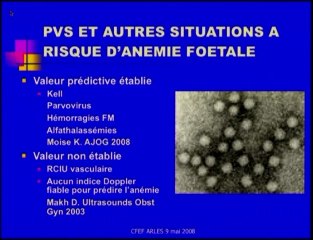 Anémie foetale