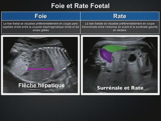 POSTER Foie Rate Reins