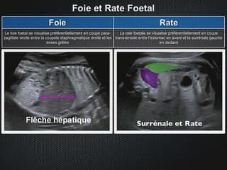 POSTER Foie Rate Reins