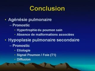 Hypoplasie et agénésie pulmonaire L’imagerie fœtale