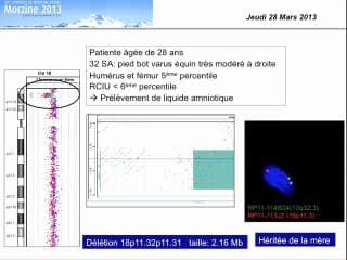CGH Array : nouvelles stratégies