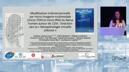 Modélisation tridimensionnelle par micro-imagerie multimodale (TDM et IRM) du fœtus humain a 12 SA dans le cadre du projet FETTAL