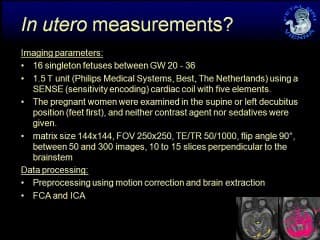 étude IRM de la fonction cérébrale foetale au repos ( en ANGLAIS )