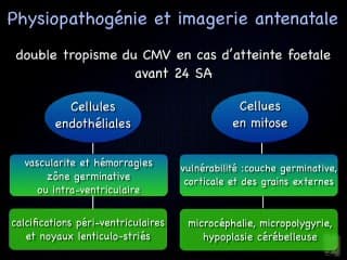 CMV : Quand évoquer une infection a_ CMV lors d'une échographie de dépistage ?