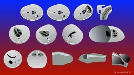 L’étude FLASH du CFEF sur le cliché du col