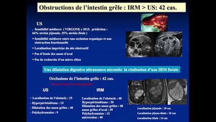TUBE DIGESTIF  Cas cliniques