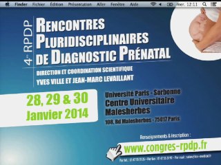 Maladie osseuse : le foetus impensable.