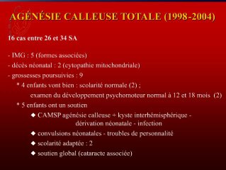 Quand demander une surveillance neuro-pédiatrique ?