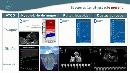 Recommandations CNEOF 2016 : les inchangés et les nouveautés Y a-t-il des indications à examiner le coeur au 1er trimestre, et comment je fais