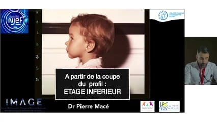 A partir de la coupe du profil : étage inférieur