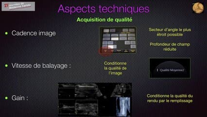 os longs courts : apports de l’échographie volumique dans l’étude de l’os fœtal