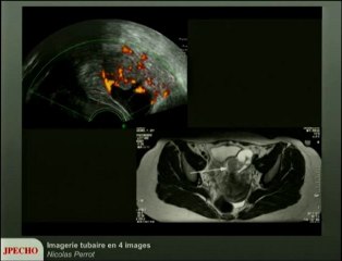 Imagerie tubaire en 4 images
