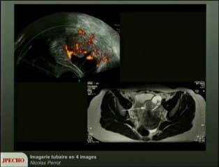 Imagerie tubaire en 4 images