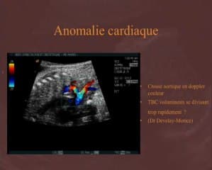 Le rein foetal génétique