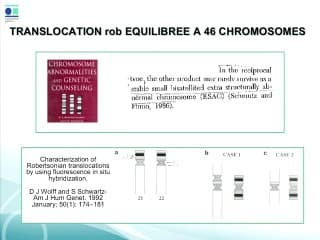 Présentation d'un diagnostic différentiel de translocation robertsonnienne rob (21,22)P.
