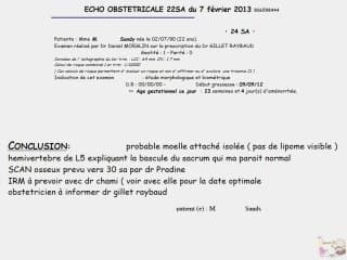 Rachis "angulé" précoce.