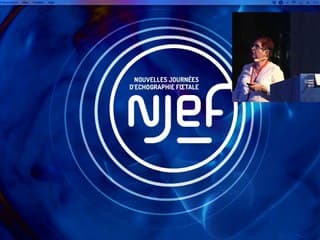 microcéphalie récidivente