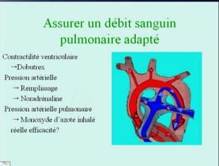Hernie diaphragmatique : point de vue du chirurgien